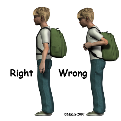child's posture with back pack